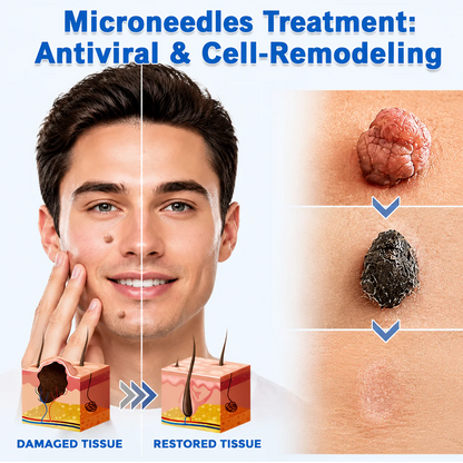 Careerel ® 2-in-1 Microneedle & Hydrocolloid Patch👨‍⚕️ | Removes raised moles, acne, flat warts, and skin tags | Helps improve wrinkles, scars, and blemishes | Invisible patches for face and body💖