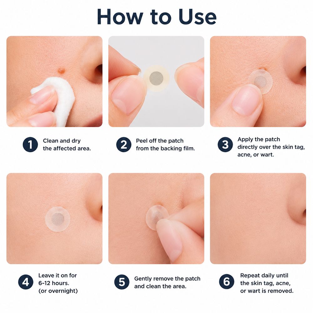 Careerel ® 2-in-1 Microneedle & Hydrocolloid Patch👨‍⚕️ | Removes raised moles, acne, flat warts, and skin tags | Helps improve wrinkles, scars, and blemishes | Invisible patches for face and body💖