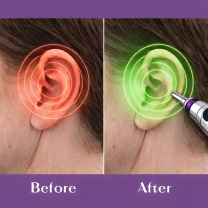 Careerel™ By Xeviola | Stop Ringing Ears in Seconds